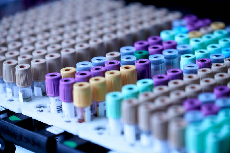 Rack of blood samples